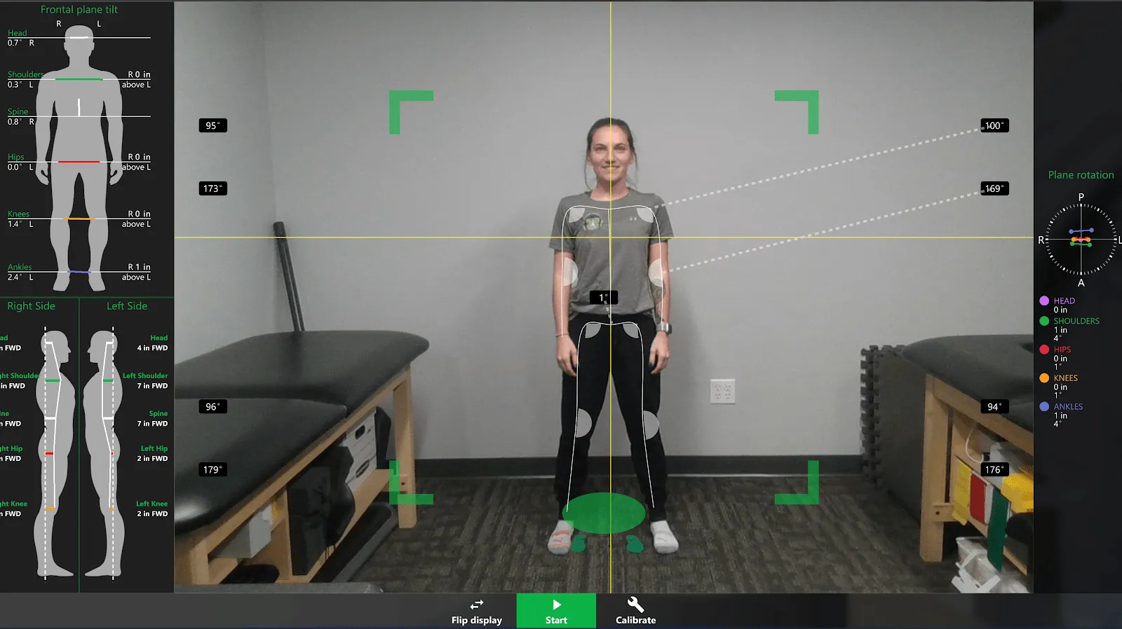 Y Strap Treatment — Functional Performance Institute