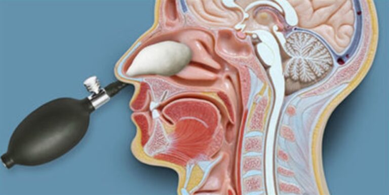 Nasal Cranial Adjusting