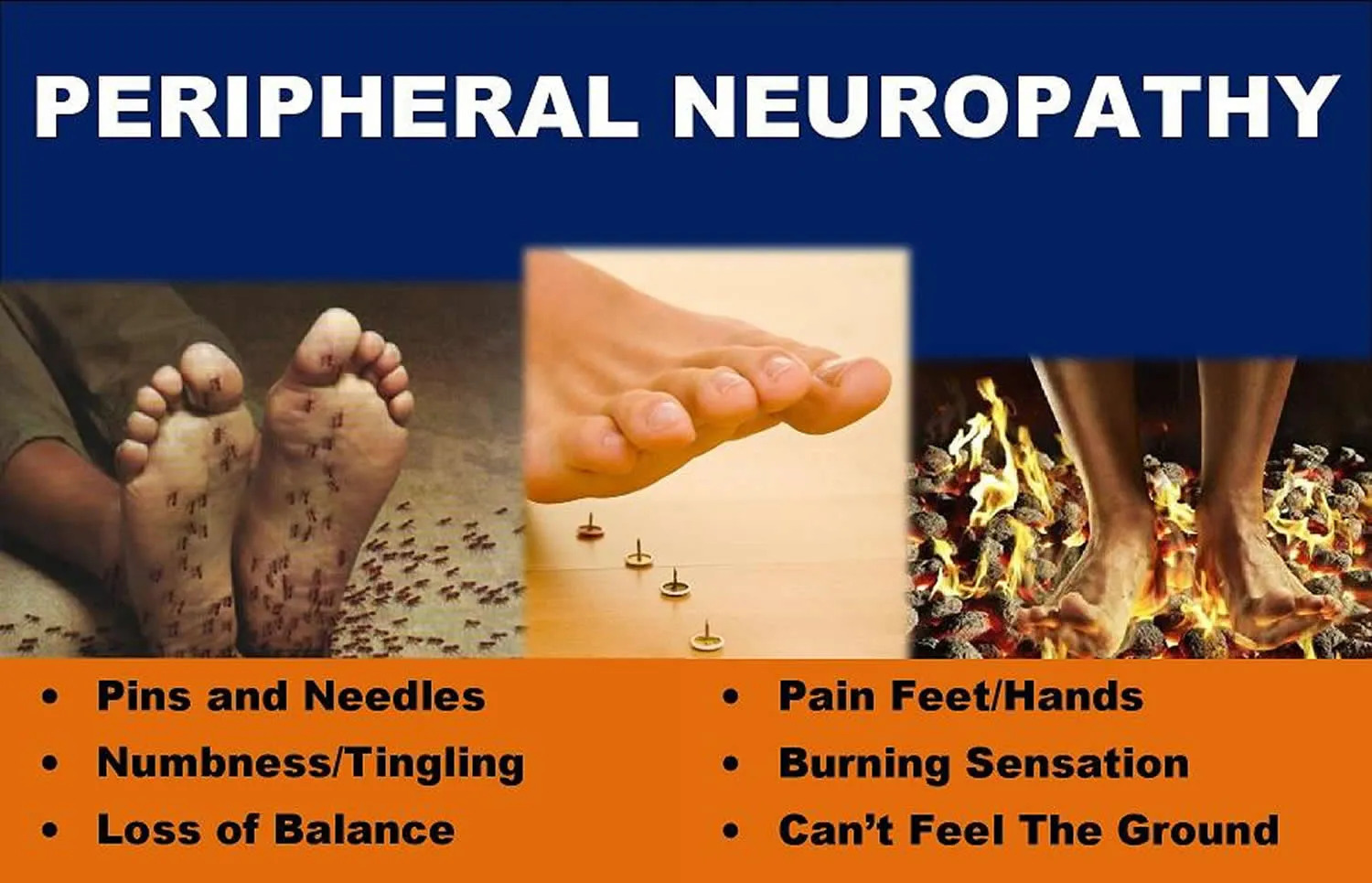 Best Treatment For Peripheral Diabetic Neuropathy At Michael Noonan Blog